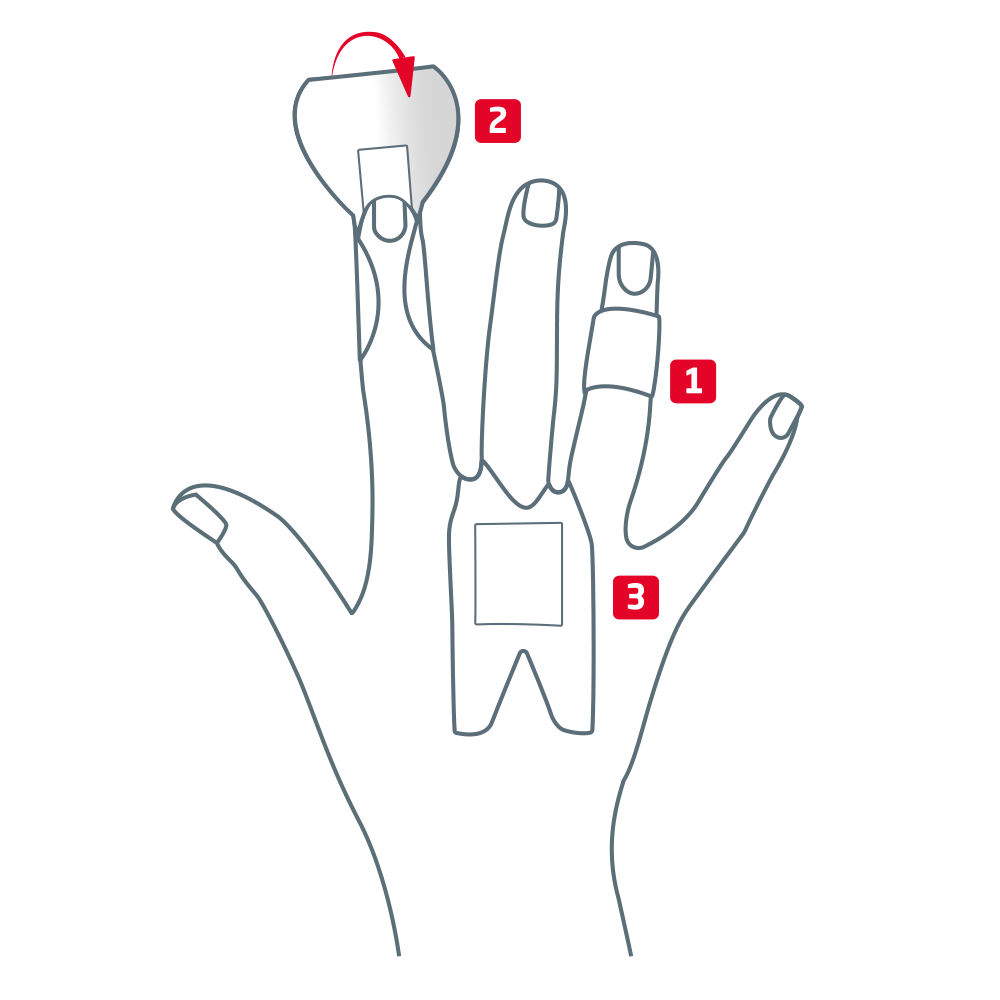 Übersicht der verschiedenen Optionen für Fingerknöchel, Fingerglieder und Fingerspitzen Übersicht der verschiedenen Optionen für Fingerknöchel, Fingerglieder und Fingerspitzen